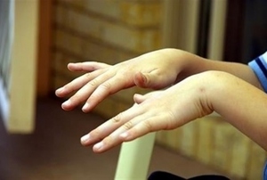 Симптомы тремора рук